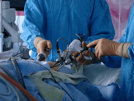 Chirurgický zásah